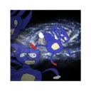 ਸਟਿਕਰ
