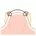 贴纸